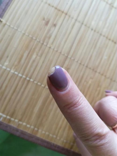 Девочки, нужен совет. 01