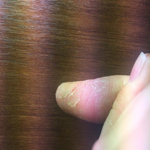 Девочки, выручайте!  Невозможно дотрагиваться до чего-либо. 01