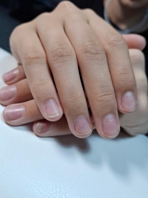 Расскажу секрет, как избавиться от аллергии и онихолизиса навсегда и не отказывать себе в маникюре. 02