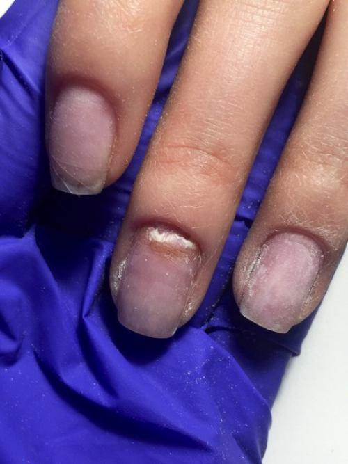 Анонимно.  Девочки, вот такая вот проблема у клиентки. 01