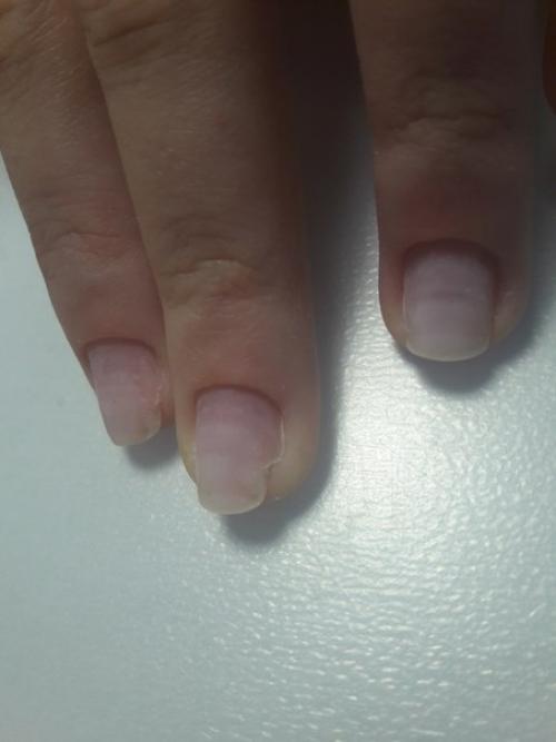 Здравствуйте девочки, подскажите, пожалуйста, как отрастить ноготки? 01