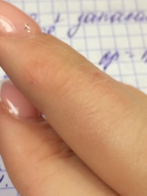 Девочки, что это такое может быть? 01