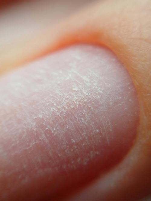 Чистый маникюр играет важную роль в носке покрытия гель - лаком или лаком. 01