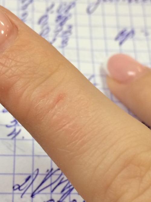 Девочки, что это такое может быть? 02