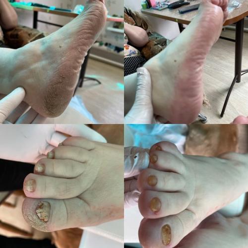 Лето ассоциируется у нас с новыми эмоциями и яркими впечатлениями так что, и маникюр - педикюр хочется иметь соответствующий настроению. 07