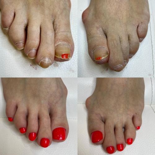 Лето ассоциируется у нас с новыми эмоциями и яркими впечатлениями так что, и маникюр - педикюр хочется иметь соответствующий настроению. 04