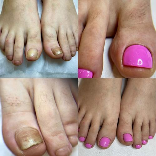 Лето ассоциируется у нас с новыми эмоциями и яркими впечатлениями так что, и маникюр - педикюр хочется иметь соответствующий настроению. 09