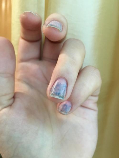 Девушки - мастерицы, подскажите пожалуйста из-за чего такое может быть? 01