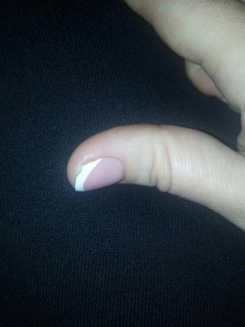 Девочки спасите - помогите! 01