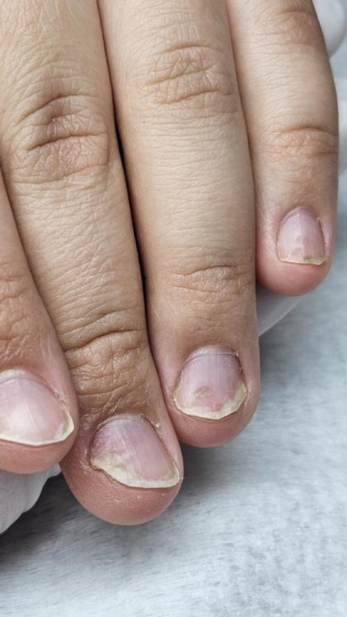 Лето - прекрасная пора похвастаться красивым маникюром. 01 Лето - прекрасная пора похвастаться красивым маникюром. 01