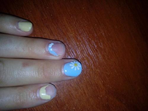 Девушки, подскажите, как быть с грызунами сделала девушке покрытие на ногти, у которых даже свободного края не было (14 июля. 01