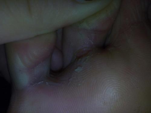 Девочки помогите!  У мужа с ножками такая беда. 02