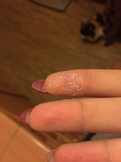 Всем привет?  Девочки может было у кого так? 01