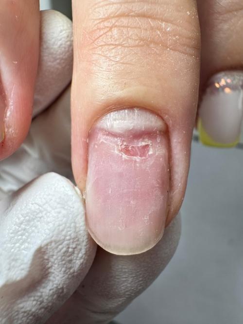 Вот эти 2 пальчика. 01 Вот эти 2 пальчика. 01