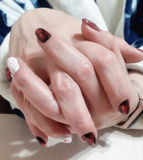 Когда заканчивается болезнь, начинается выздоровление и. творчество! 01