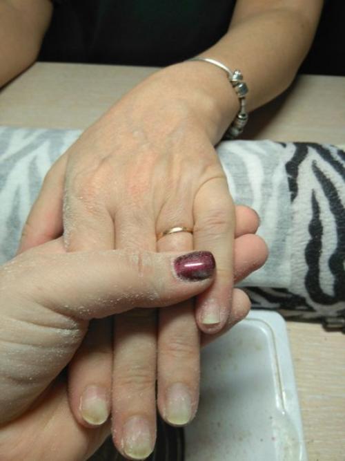 Добрый день!  Пришла клиентка на маникюр, сказала что чистила апельсин и под ногти набилось. 01