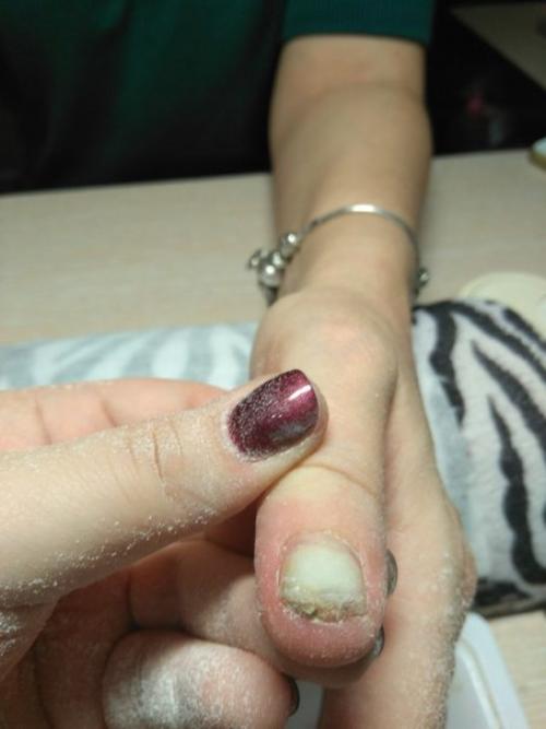 Добрый день!  Пришла клиентка на маникюр, сказала что чистила апельсин и под ногти набилось. 02