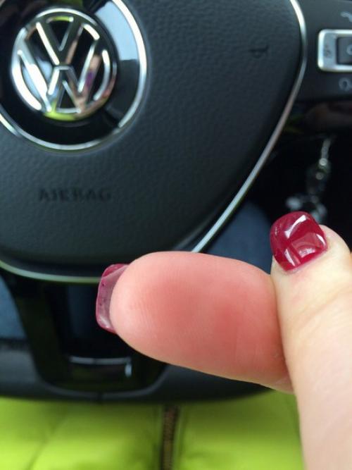 Девочки привет подскажите что может этому способствовать? 01