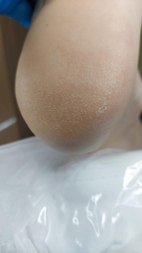 Почему за педикюром обращаются меньше чем за маникюром? 06