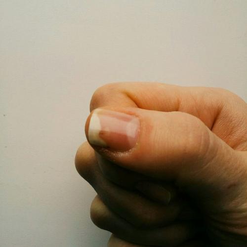 Девочки, помогите?  Кто сталкивался с таким, скажите пожалуйста какова может быть причина, и как это лечить. 01