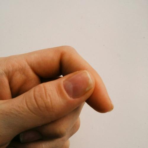 Девочки, помогите?  Кто сталкивался с таким, скажите пожалуйста какова может быть причина, и как это лечить. 02