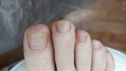 Почему за педикюром обращаются меньше чем за маникюром? 02