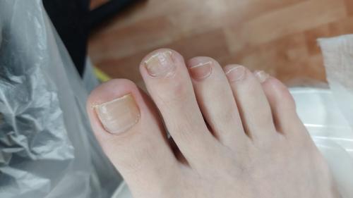Почему за педикюром обращаются меньше чем за маникюром? 03