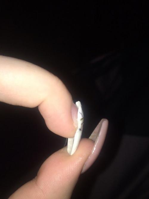 Девочки, помогите, от чего такое может быть? 01