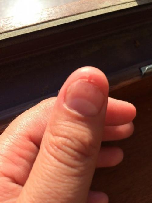 Девочки помогите пожалуйста, девушка отправила фото ноготков, спрашивает что это может быть, и можно ли наращивать ноготки! 01