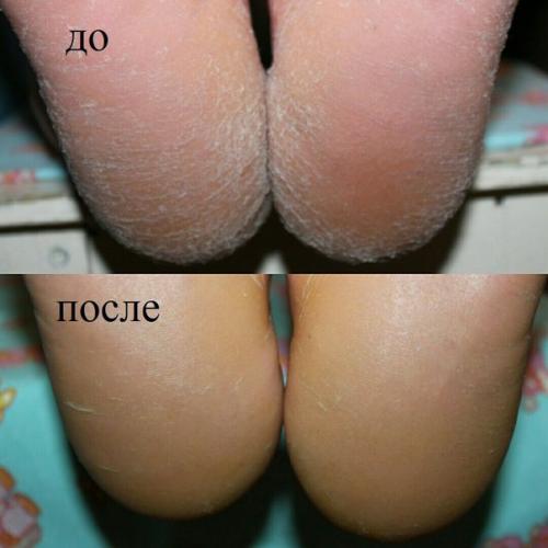 Здравствуйте, у меня случилась не очень приятная ситуация и хотела бы услышать совет как в следующий раз поступать. 02