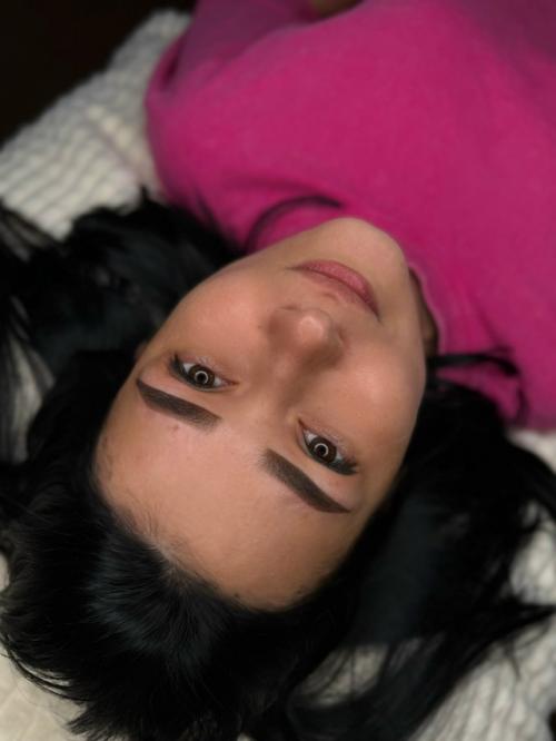 На первом фото брови до после 3 х процедур лазерного удаления. 02