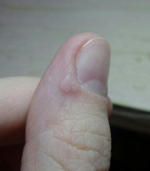 Админ.  Пропусти пожалуйста. 03