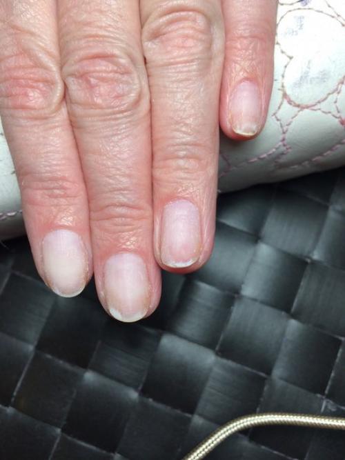 Подскажите пожалуйста что можем быть с ногтем? 01