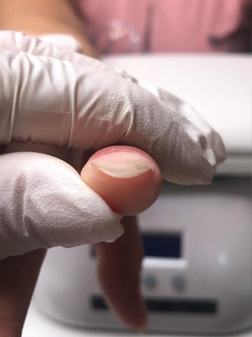 Маникюр животворящий!   Посмотри все фото и увидишь как эти ногти выглядели в первый визит (не со всех ракурсов к сожалению, ну уж что есть. 02