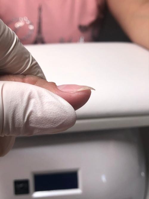 Маникюр животворящий!   Посмотри все фото и увидишь как эти ногти выглядели в первый визит (не со всех ракурсов к сожалению, ну уж что есть. 05