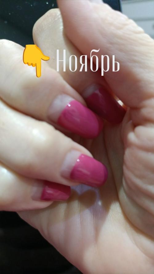 У кого-нибудь растут так ногти за 1 месяц? 01