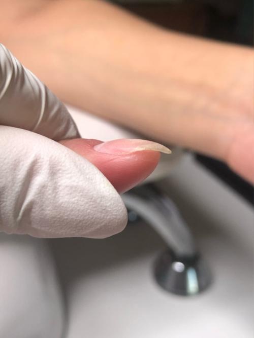 Маникюр животворящий!   Посмотри все фото и увидишь как эти ногти выглядели в первый визит (не со всех ракурсов к сожалению, ну уж что есть. 01