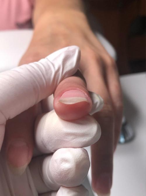 Маникюр животворящий!   Посмотри все фото и увидишь как эти ногти выглядели в первый визит (не со всех ракурсов к сожалению, ну уж что есть. 04