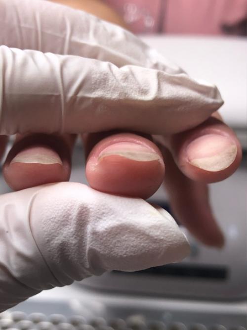 Маникюр животворящий!   Посмотри все фото и увидишь как эти ногти выглядели в первый визит (не со всех ракурсов к сожалению, ну уж что есть. 03