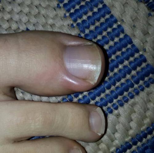 Пожалуйста, анонимно?  Заранее большое спасибо! 01