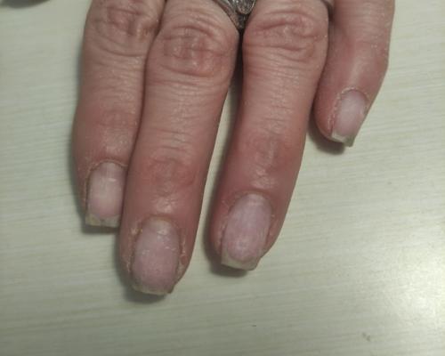 Невозможно представить себе красивый маникюр с разросшейся, неухоженной кутикулой. 01