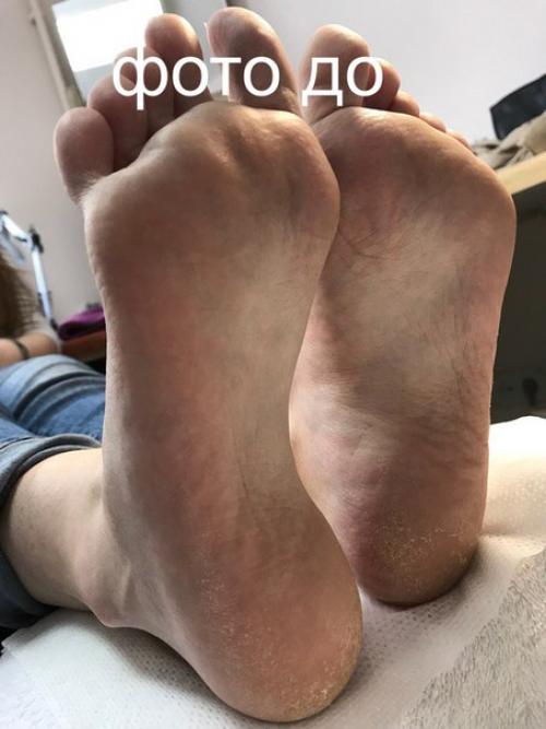 Ошибки.  Мой мой первый профи педикюр.  курс по классике прошла. 05