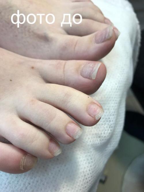 Ошибки.  Мой мой первый профи педикюр.  курс по классике прошла. 06