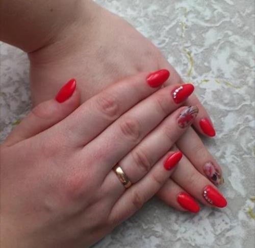 Анонимно, пожалуйста. Здравствуйте. 04