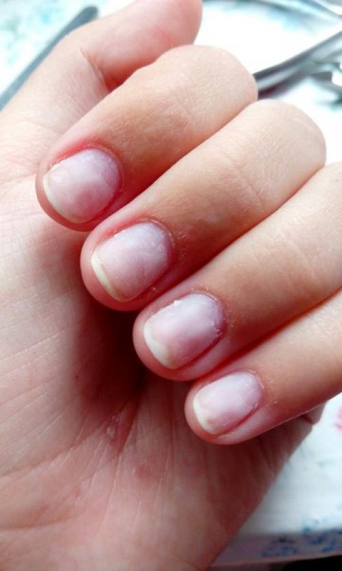 Помогите пожалуйста советом, от чего это возможно? 01