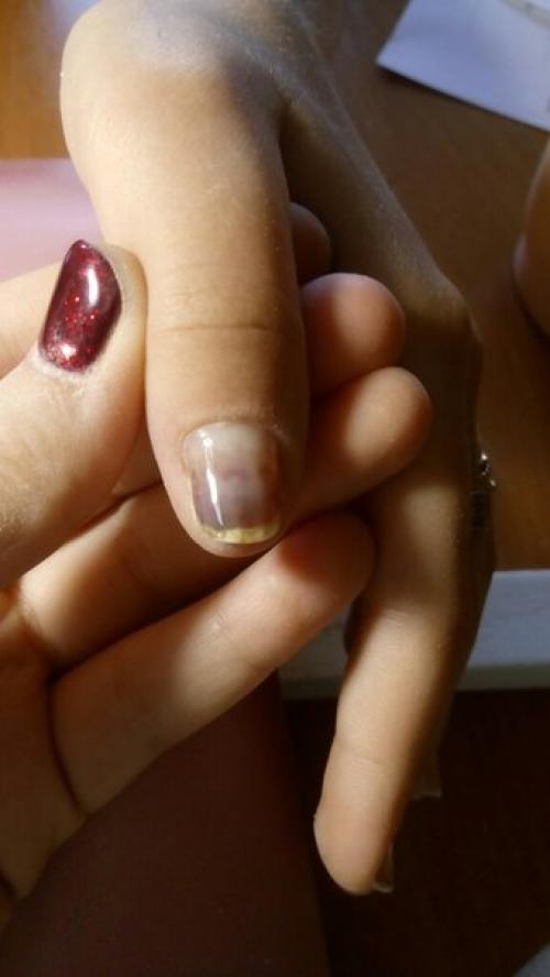 Анон.  Подскажите пожалуйста! 02