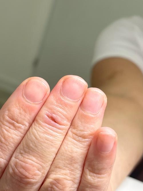 Рекомендуемое время между гигиеническими обработками ногтей на руках без покрытия - 10-14 дней. 04