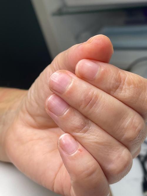 Рекомендуемое время между гигиеническими обработками ногтей на руках без покрытия - 10-14 дней. 03