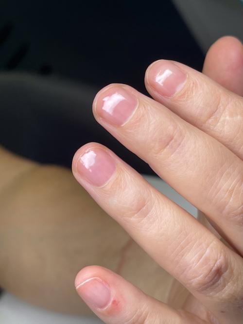 Рекомендуемое время между гигиеническими обработками ногтей на руках без покрытия - 10-14 дней. 02