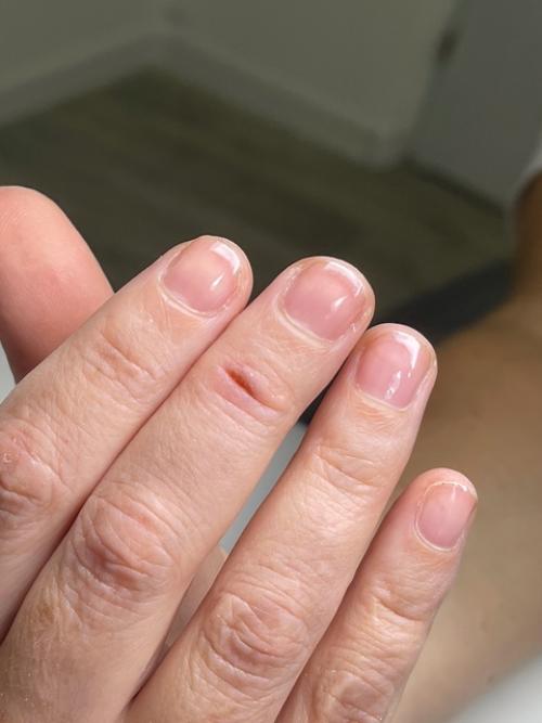 Рекомендуемое время между гигиеническими обработками ногтей на руках без покрытия - 10-14 дней. 05